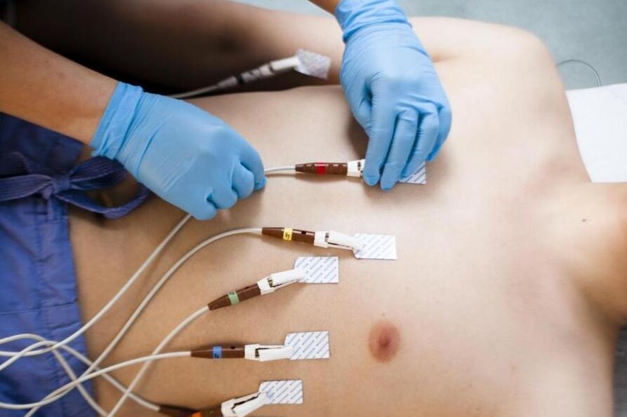 Elektrokardiogram